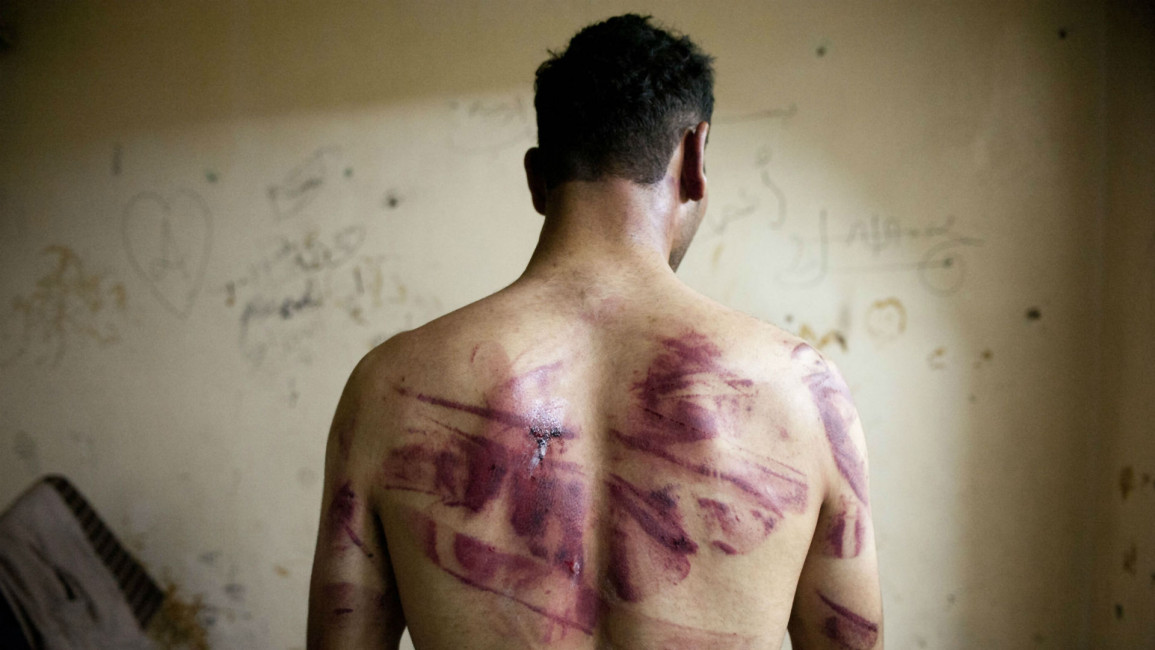 Syria torture