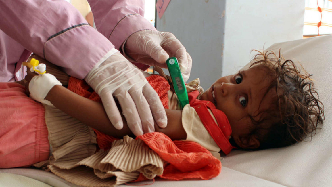 Yemen children cholera - AFP