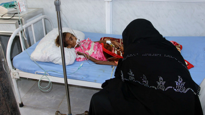 CHild malnutrition Yemen AFP